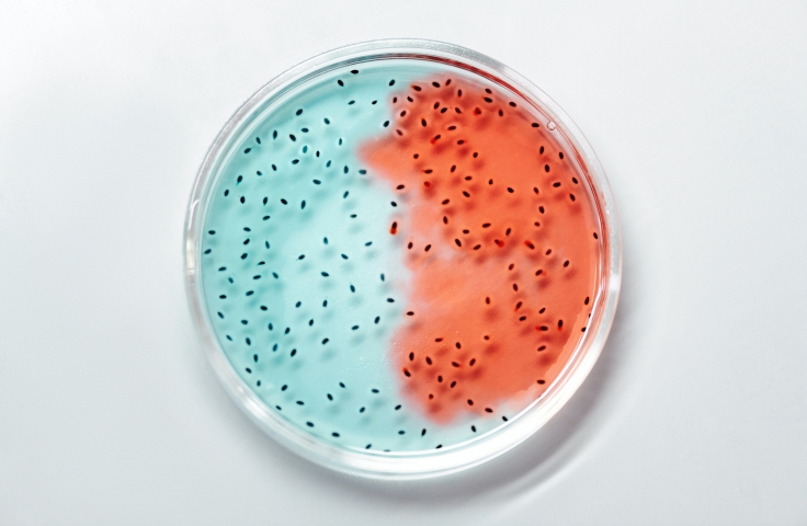 Cells in a petri dish